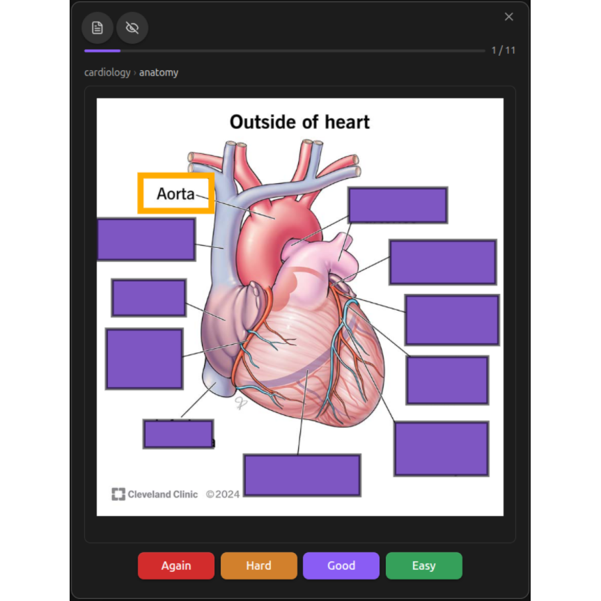 Placeholder: an image occlusion card, masks over a diagram